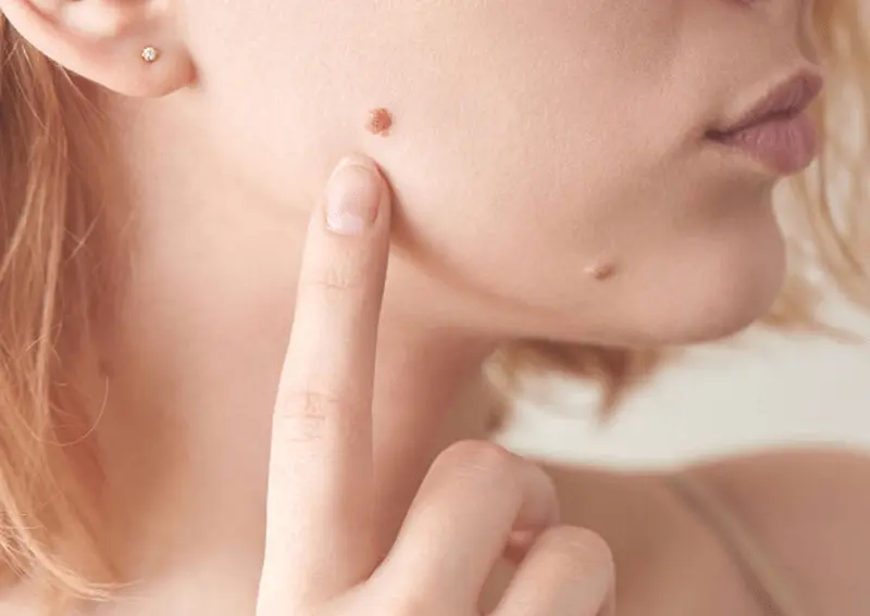 phòng khám da liễu tây ninh phòng khám da liễu tây ninh