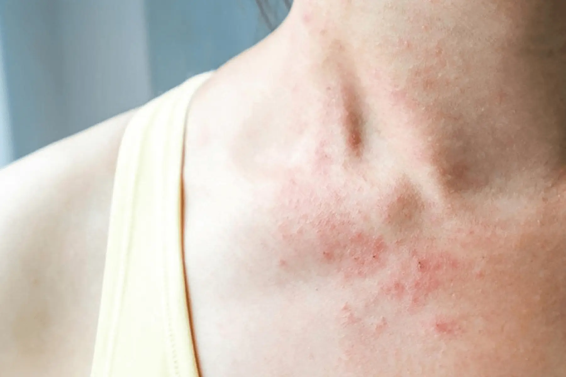 phòng khám da liễu tây ninh phòng khám da liễu tây ninh