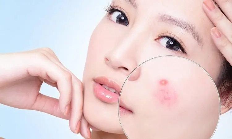 Top 5 Phòng Khám Da Liễu Mỹ Tho Cực Hay Và Uy Tín