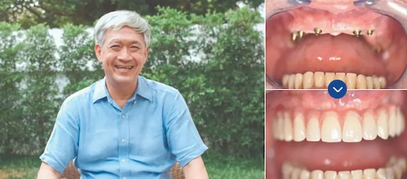 phòng khám nha khoa Quảng Ninh khám nha