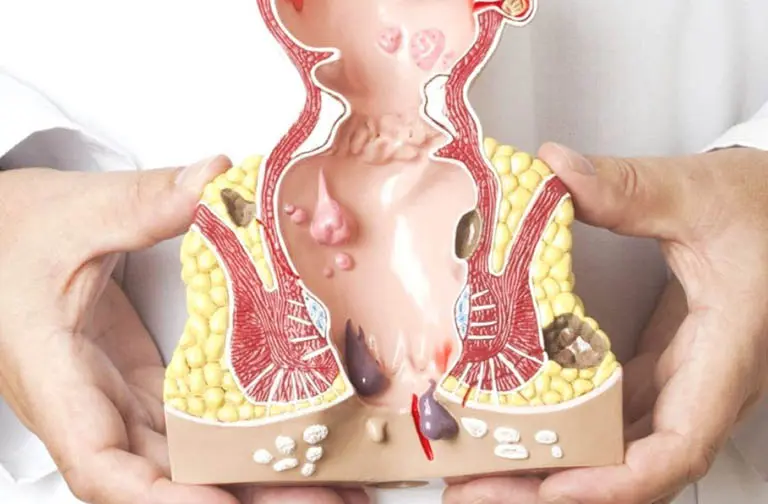 phòng khám trĩ huế Phòng Khám BS Đoàn Thị Phương Lý
