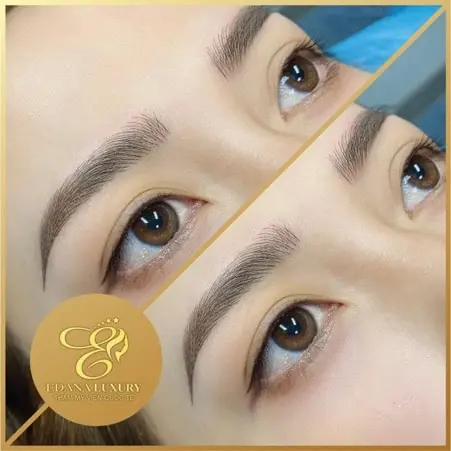 thẩm mỹ viện ở vị thanh EDANA