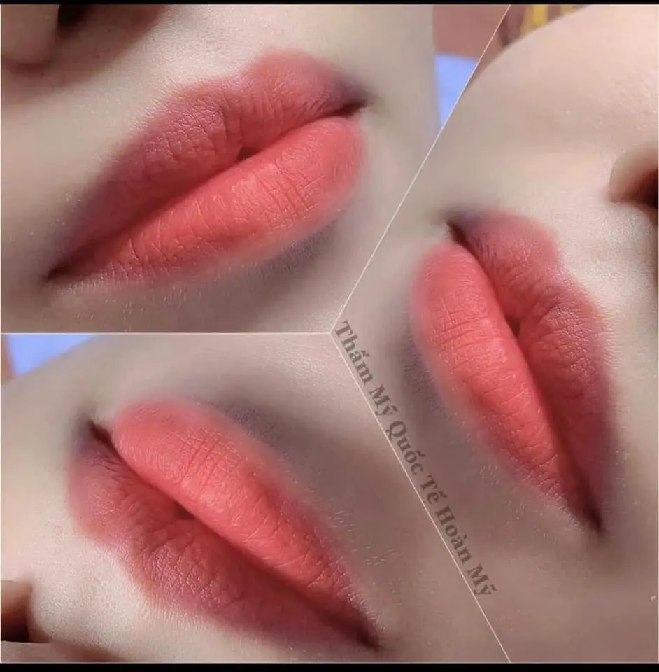 thẩm mỹ viện tại ninh thuận