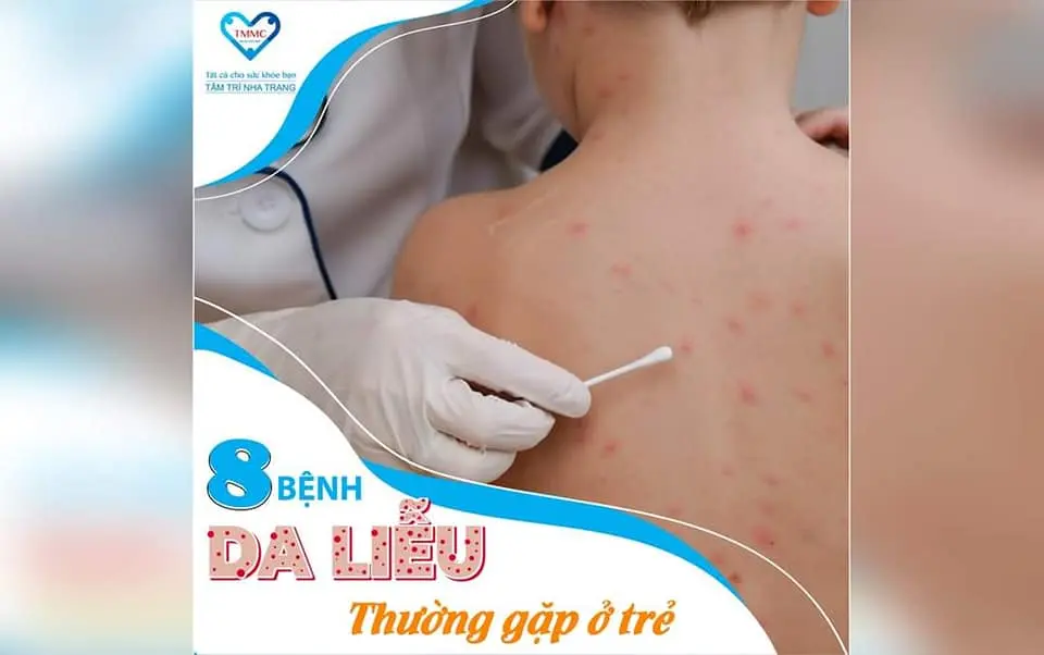 phòng khám da liễu Nha Trang Bệnh viện Đa khoa Tâm Trí Nha Trang
