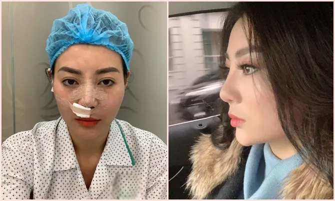 sửa cửa cuốn TPHCM sửa cửa cuốn TPHCM