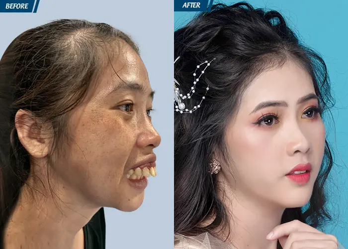 thẩm mỹ viện Cần Thơ tham-my-vien-can-tho