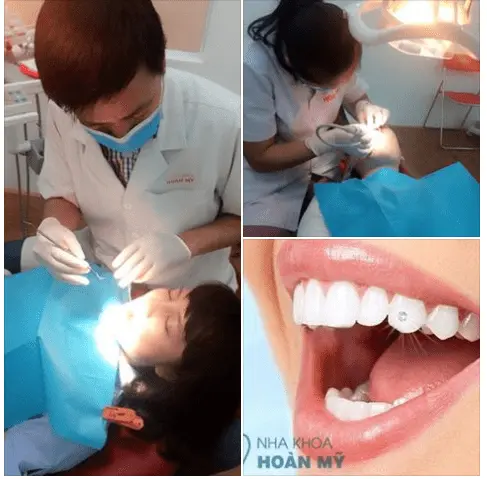 nha khoa uy tín đà nẵng