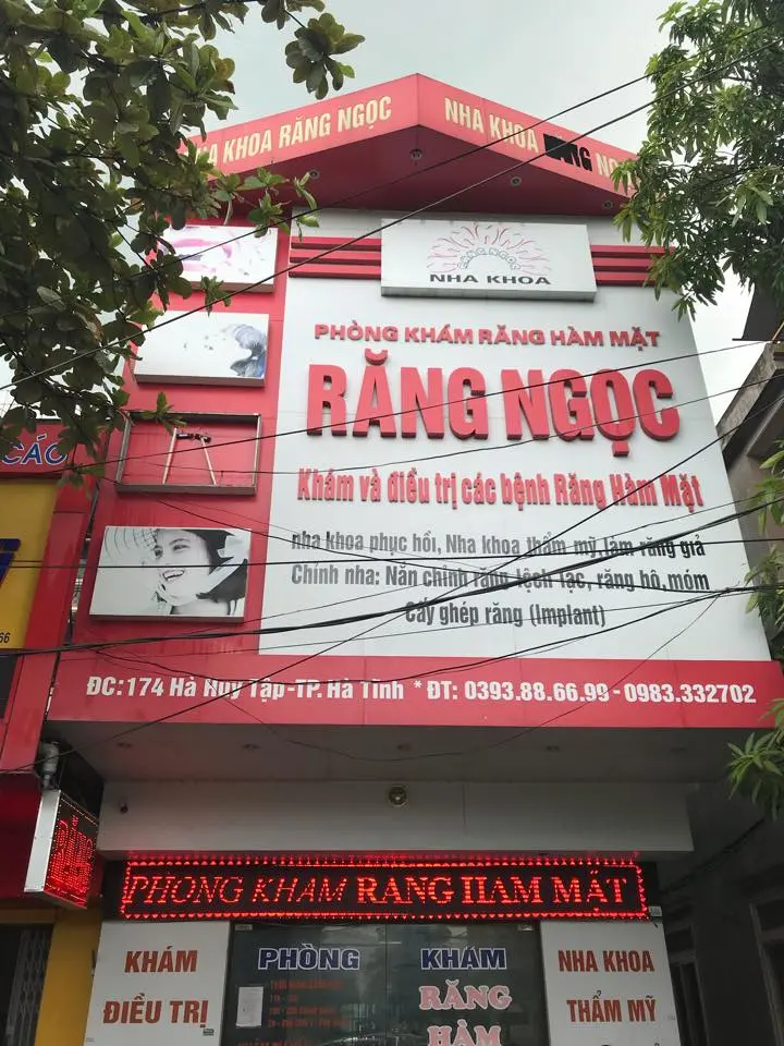 nha khoa hà tĩnh Nha Khoa Răng Ngọc