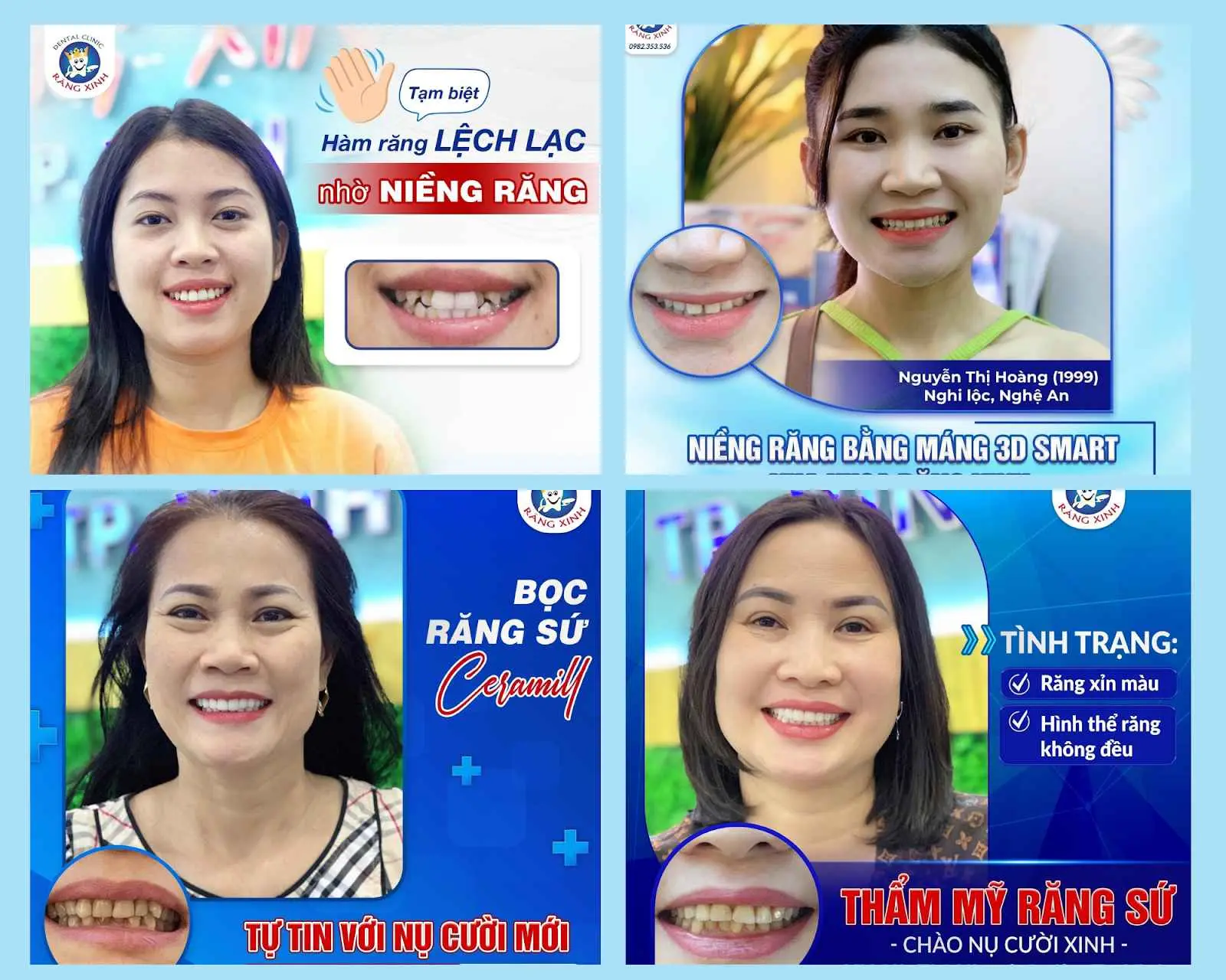 Top 11 Phòng Khám Nha Khoa Nghệ An Hàng Đầu Hiện Nay