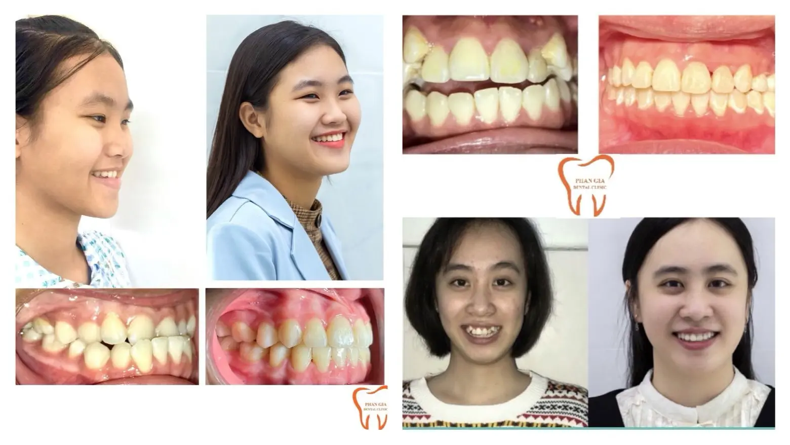 đào tạo seo đà nẵng