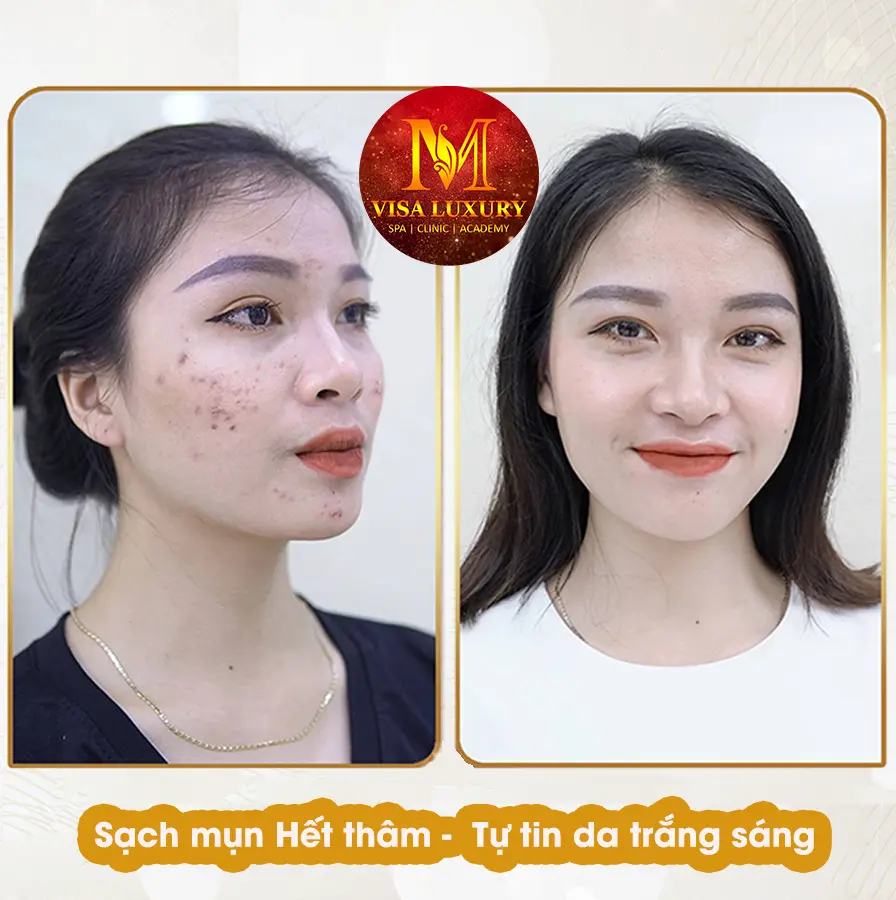 thẩm mỹ viện Cà Mau