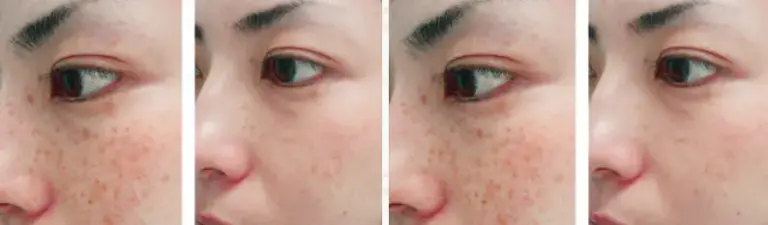 Xem Ngay Top 10 Thẩm Mỹ Viện Uy Tín Ở Buôn Ma Thuột