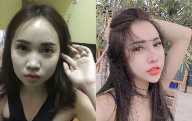 Thẩm mỹ viện Lan Hồng Kông