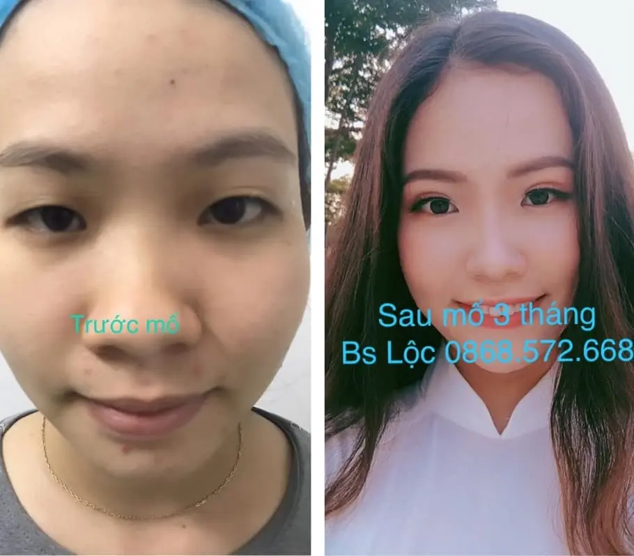 thẩm mỹ viện Quy Nhơn