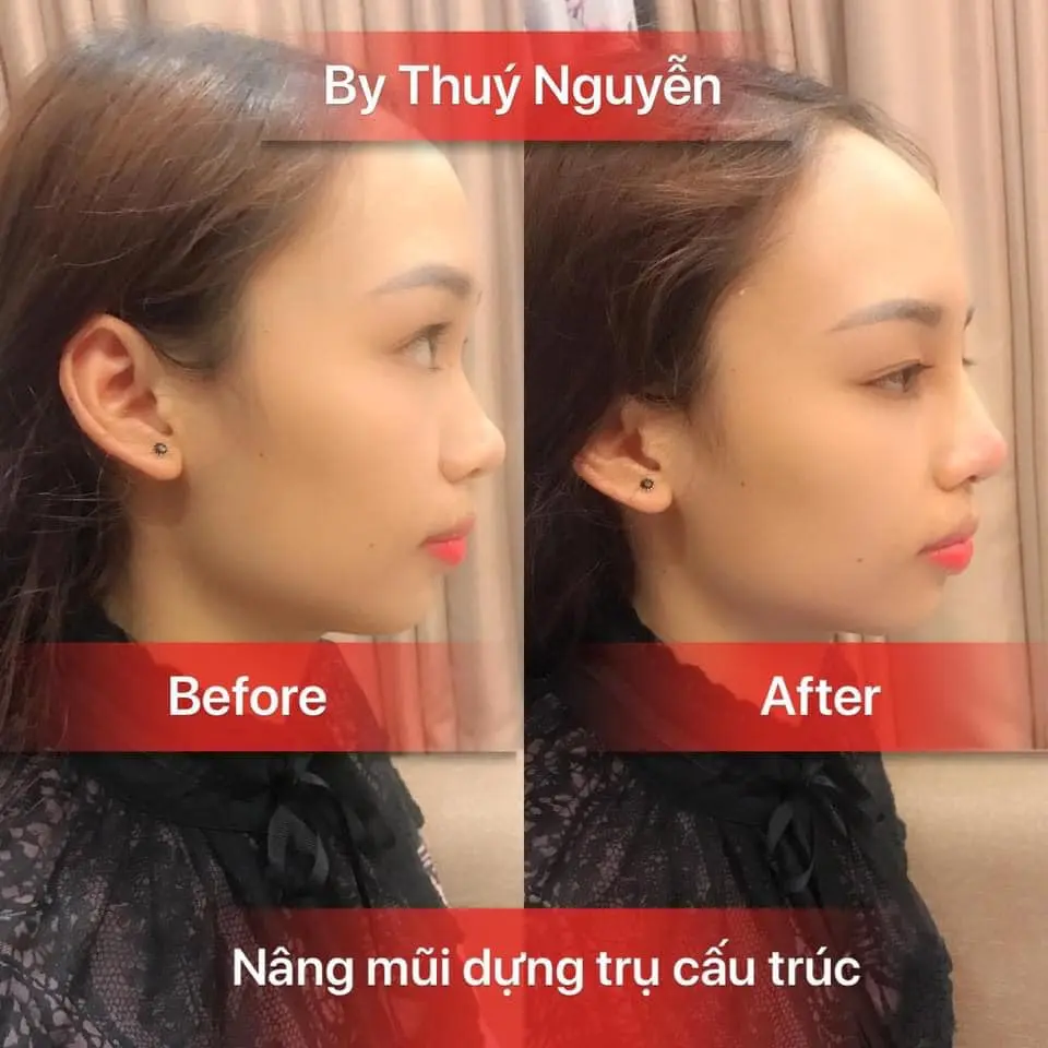 thẩm mỹ viện Quy Nhơn