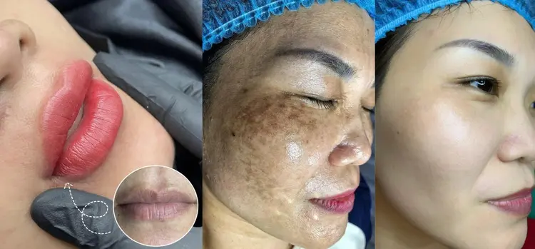 thẩm mỹ viện Sóc Trăng