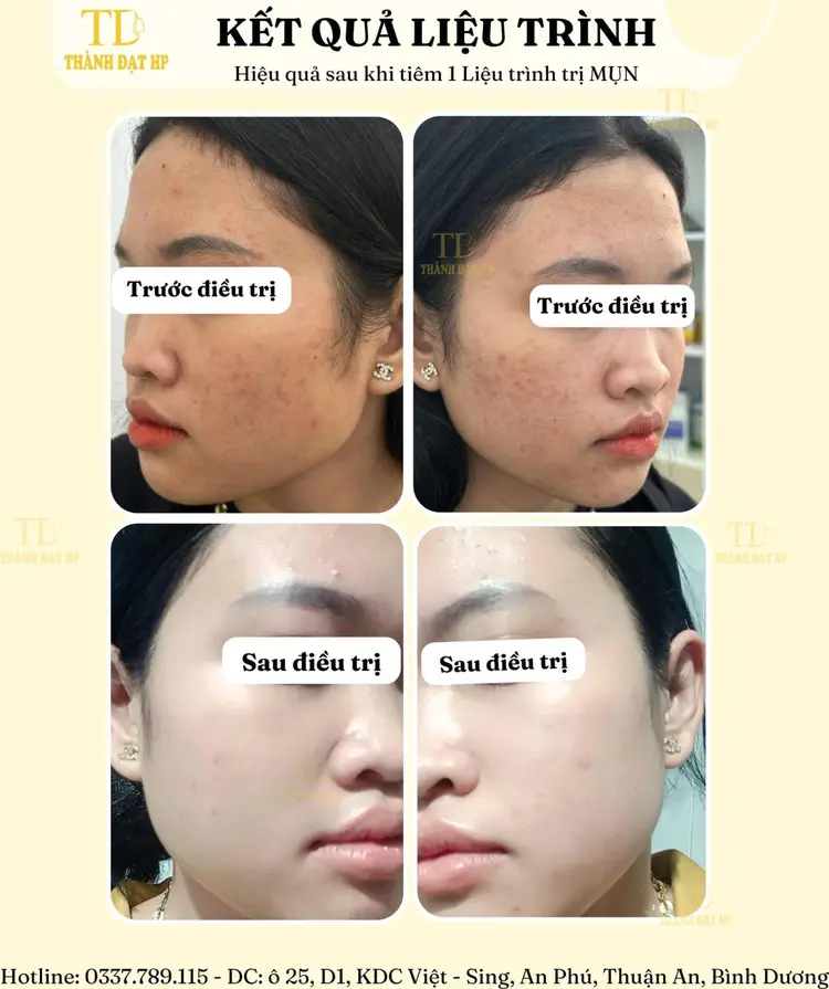 phòng khám da liễu Bình Dương phòng khám da liễu Bình Dương
