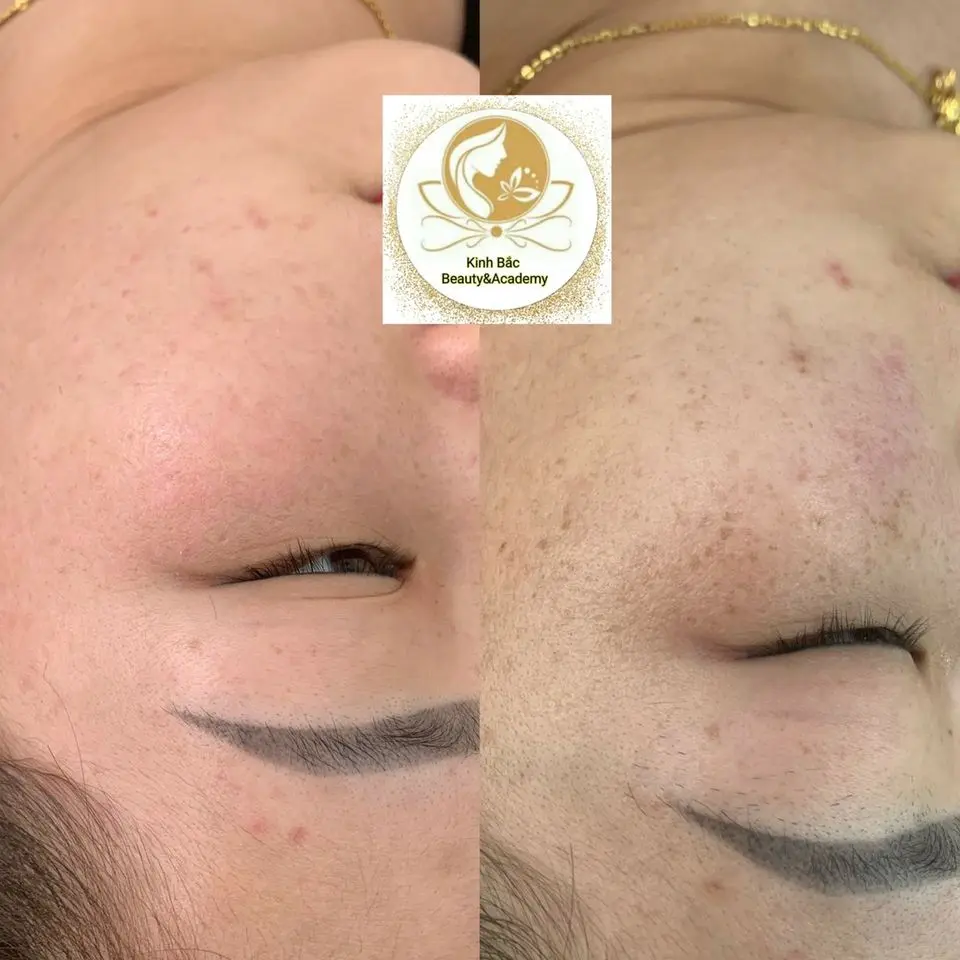 thẩm mỹ viện Bắc Ninh thẩm mỹ viện Bắc Ninh