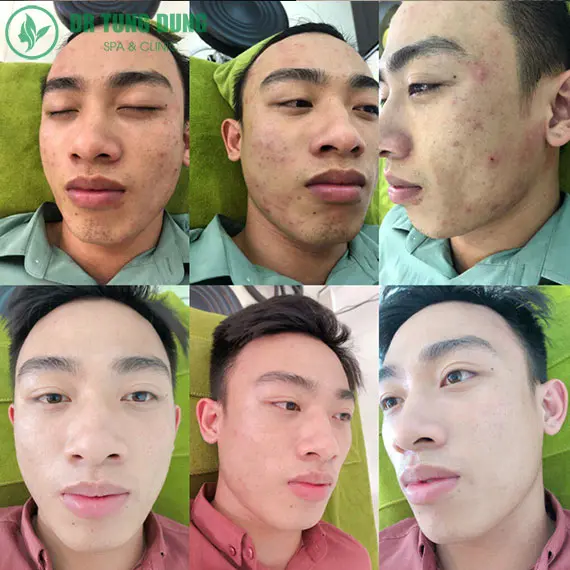 thẩm mỹ viện hải dương thẩm mỹ viện hải dương
