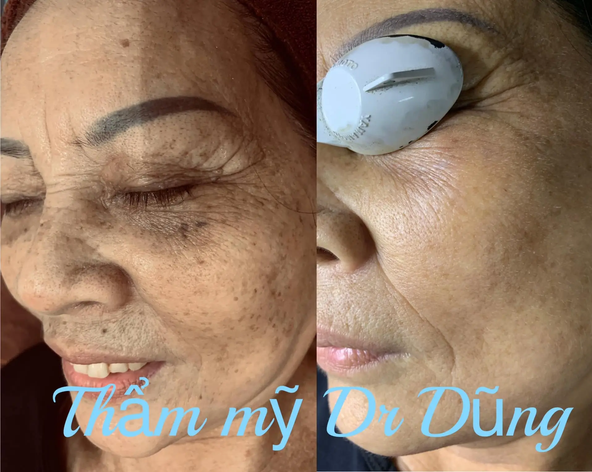 thẩm mỹ viện hải dương thẩm mỹ dr dũng