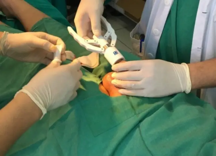 cắt bao quy đầu Thái Nguyên cắt bao quy đầu Thái Nguyên