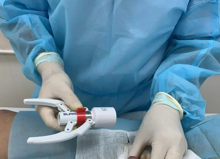 cắt bao quy đầu Thái Nguyên Bệnh Viện Y Học Cổ Truyền Thái Nguyên