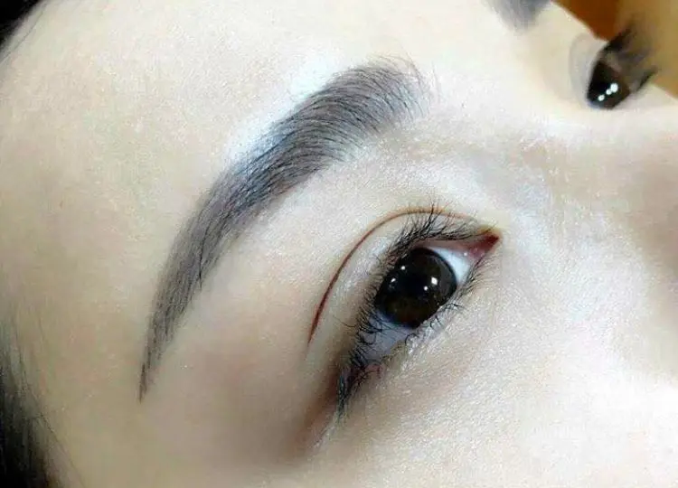 cắt mí Cần Thơ nhấn mí hiệu quả