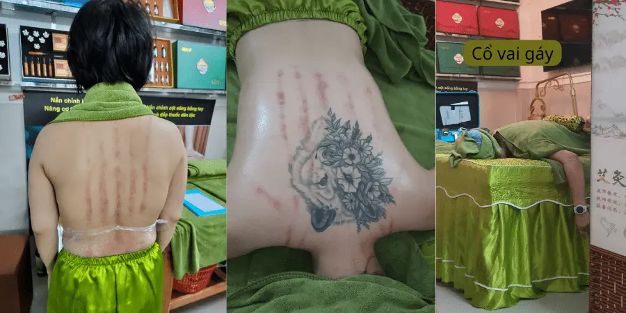 spa-massage-tri-lieu-da-nang-04 Massage Trị liệu Cổ Vai Gáy - Phin Spa Đà Nẵng