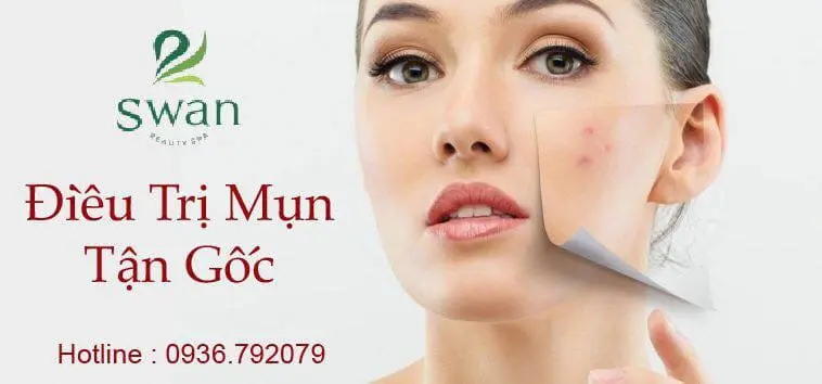 spa trị mụn Hải Phòng Swan Beauty Spa Hải Phòng