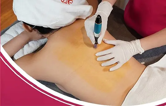 spa-tri-mun-lung-da-nang-6-min spa trị mụn lưng đà nẵng