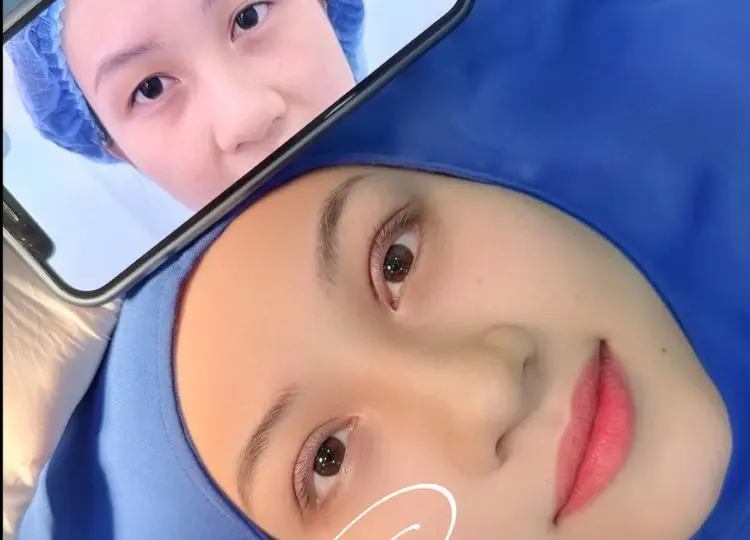 cắt mí Cần Thơ cắt mí Cần Thơ