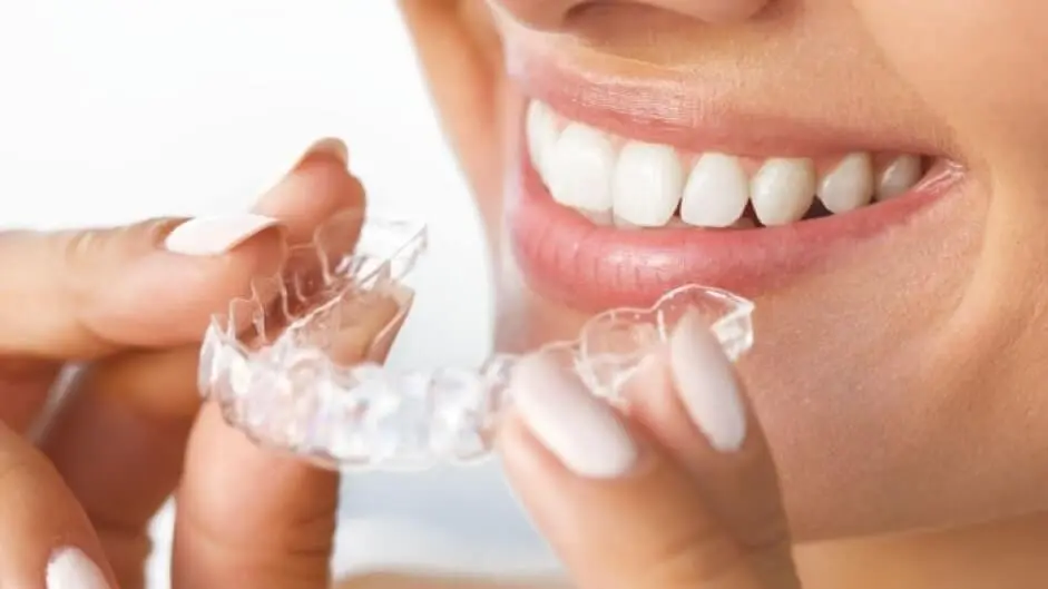 Top 5 Nha Khoa Niềng Răng Trong Suốt Hải Phòng Cực Kì Uy Tín
