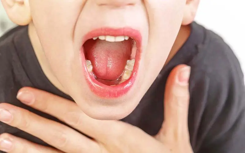 cac-benh-ly-thuong-gap-o-tre-nho-cam-sot-viem-hong-2 Viêm họng ở trẻ nhỏ