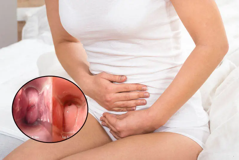 luu-y-khi-kham-phu-khoa-trong-thai-ky-viem-nhiem-am-dao Viêm nhiễm âm đạo