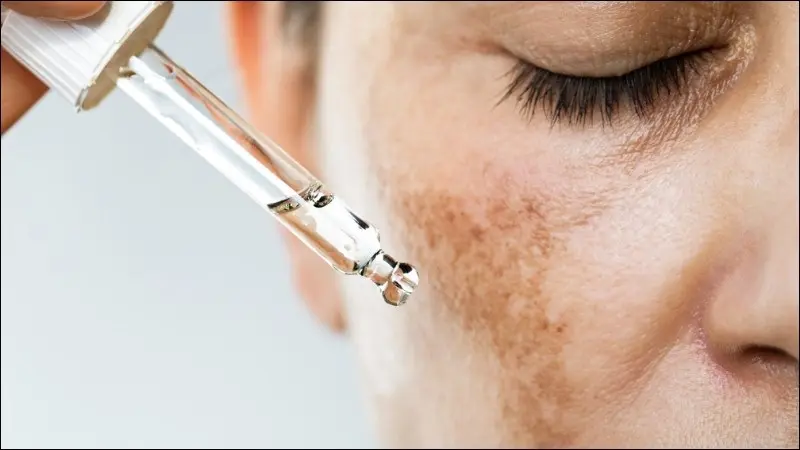 thuoc-va-san-pham-duoc-ba-si-da-lieu-khuyen-dung-2 Retinoids - Giải pháp trị mụn hiệu quả