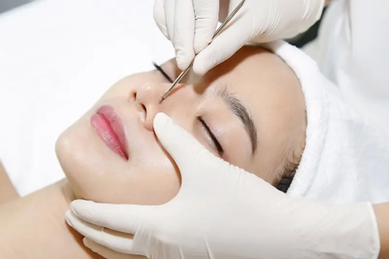 toi-thang-co-nen-di-spa-nan-mun-khong-3 tới tháng có nên đi spa nặn mụn không