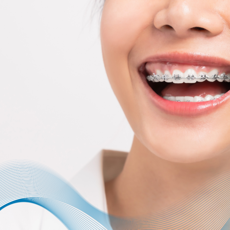 Top 5 Địa Chỉ Nha Khoa Buôn Ma Thuột Uy Tín Nhất Giúp Bạn Tự Tin Tỏa Sáng