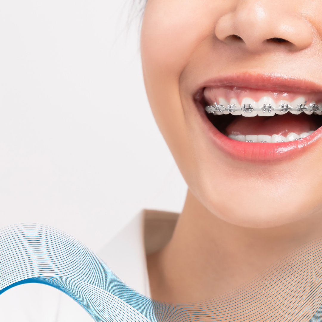 Top 5 Địa Chỉ Nha Khoa Buôn Ma Thuột Uy Tín Nhất Giúp Bạn Tự Tin Tỏa Sáng