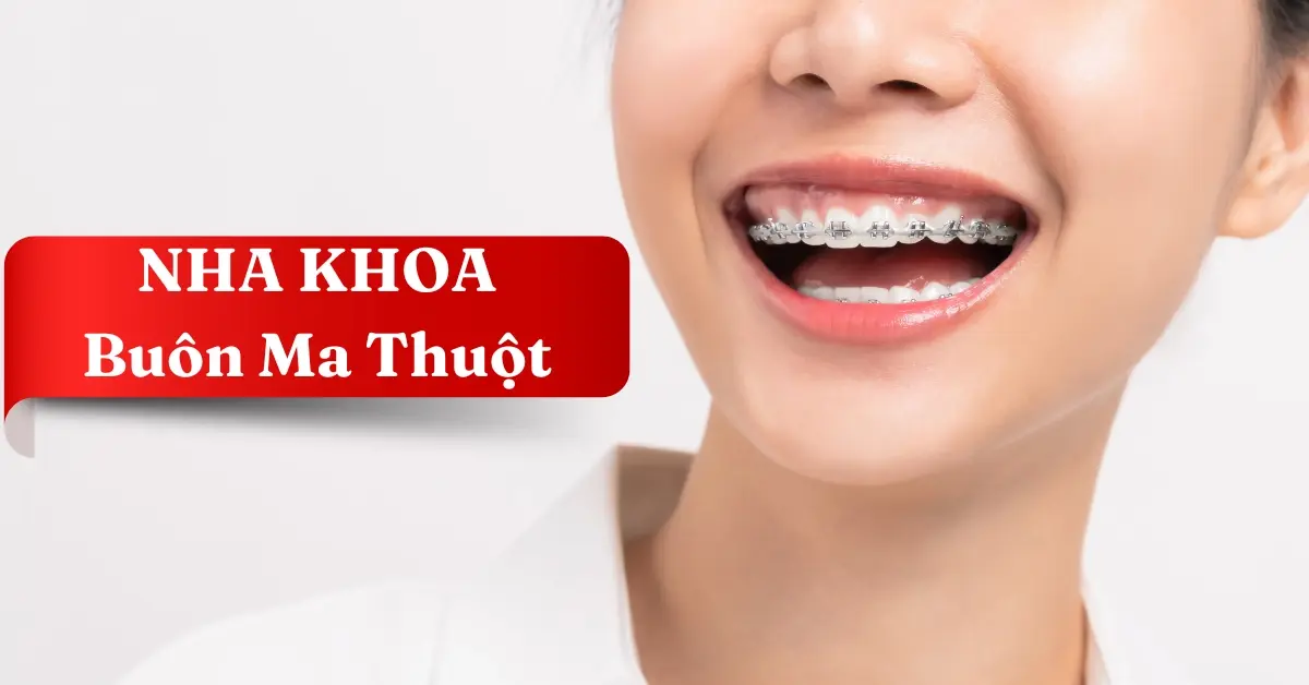 Top 5 Địa Chỉ Nha Khoa Buôn Ma Thuột Uy Tín Nhất Giúp Bạn Tự Tin Tỏa Sáng